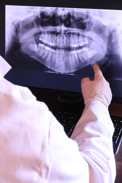 Best Emergency Treatment for Oral Infections in Perryopolis, PA