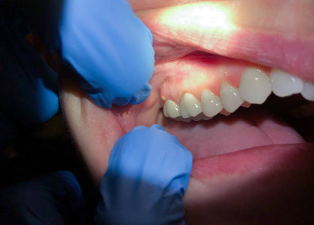 Best Lost Filling or Crown Replacement in Perryopolis, PA